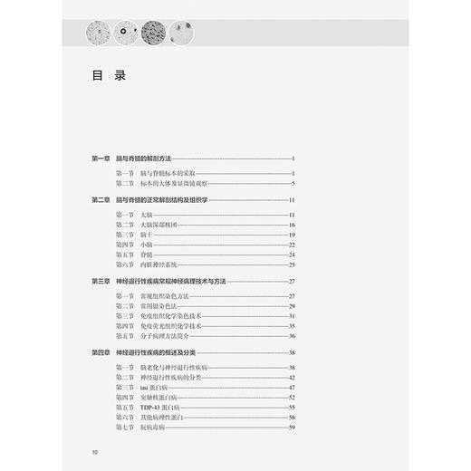 中枢神经系统退行性疾病临床神经病理学 王鲁宁等编 供从事神经科 老年科 精神科神经影像等专业的临床医师及相关基础研究人员参考 商品图3