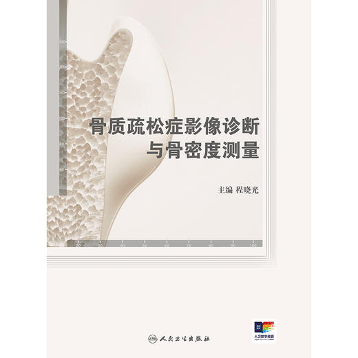 骨质疏松症影像诊断与骨密度测量 2024年12月参考书 商品图1