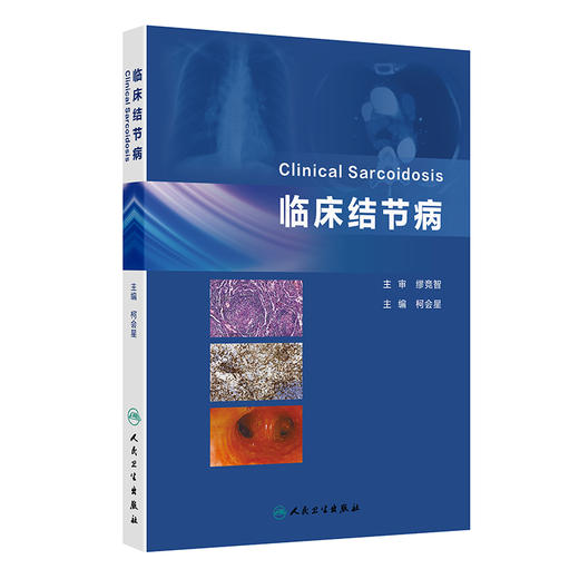 临床结节病 2024年12月参考书 商品图0