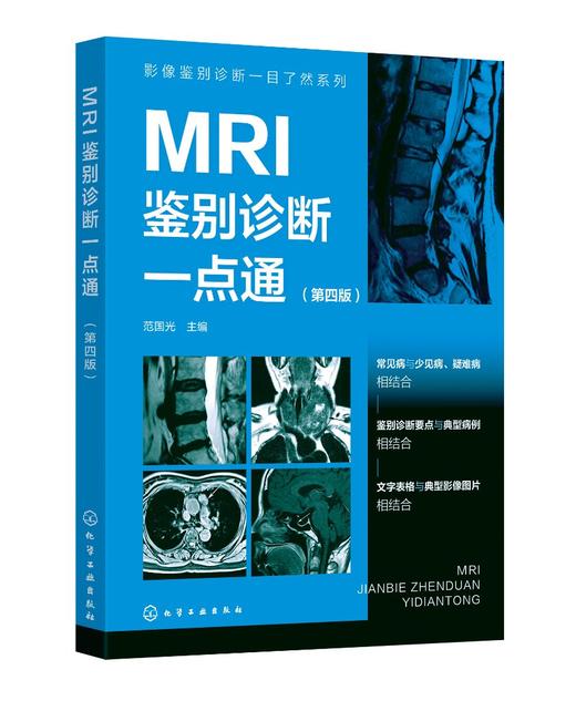 MRI鉴别诊断一点通（第四版） 商品图0