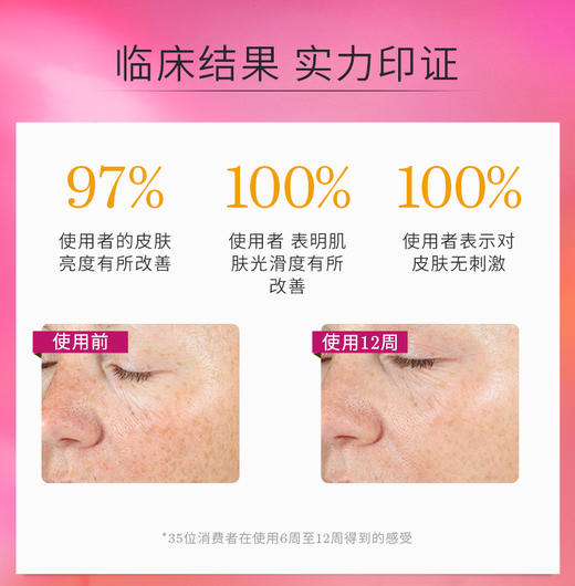 超能AC精华15ml*2 美国StriV/效期至26年5月 商品图4