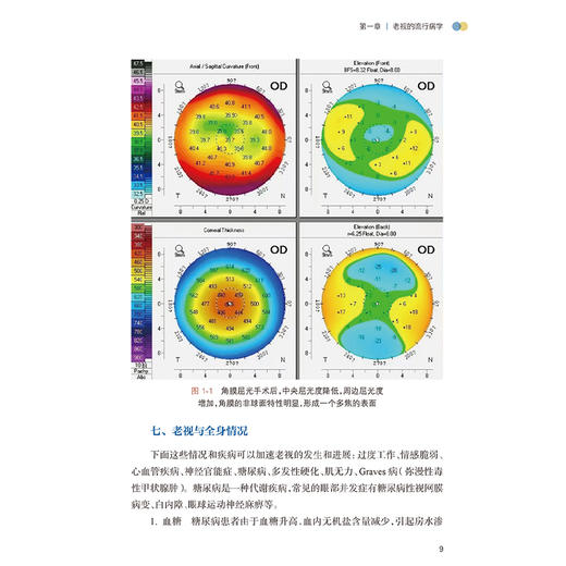 老视 黄锦海 周行涛 张丰菊 主编 老视的机制老视临床特点和矫正方法老视的心理和社会经济学 眼科学9787117372770人民卫生出版社 商品图4