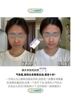 用户说丨长期吃褪黑素的副作用