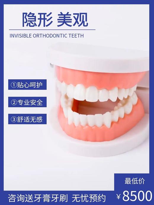 隐形美观 专业安全 咨询送牙膏牙刷 商品图0