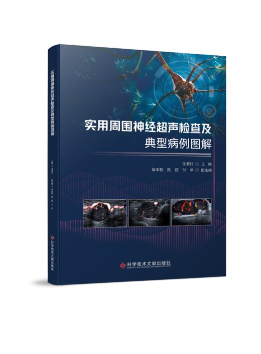正版 实用周围神经超声检查及典型病例图解 沈素红主编 商品图0