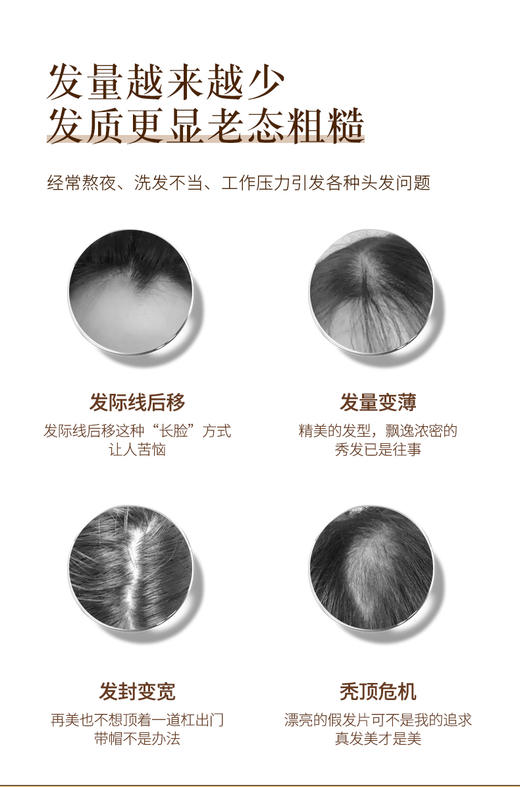 斯诺森牌生邦发豌豆分离蛋白刺梨复合片 美国原装进口 秀发营养 商品图3