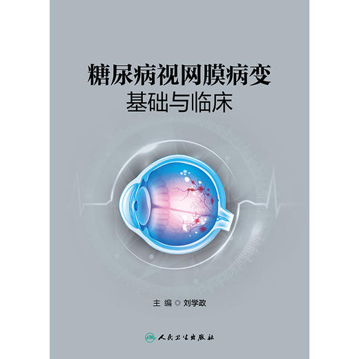 糖尿病视网膜病变基础与临床 2024年12月参考书 商品图1
