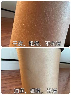 一脱秋裤都是白花花的皮屑🤦‍♀️？