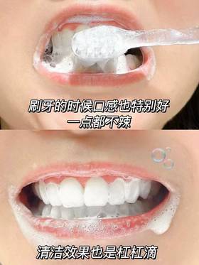 天天刷牙🦷为啥牙齿还是黄？