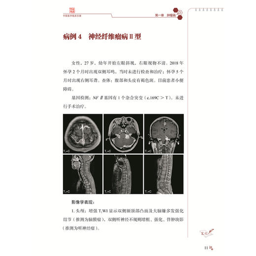 复旦大学附属华山医院中枢神经系统疑难影像病例精解 中国医学临床百家 病理精解 毛颖等主编 9787523519202科学技术文献出版社 商品图4