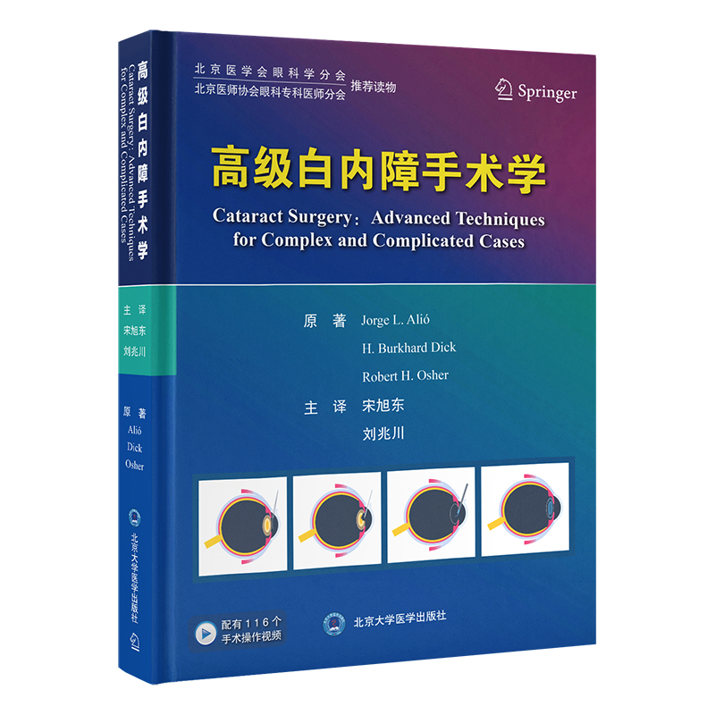 高级白内障手术学   宋旭东　刘兆川 主译   北医社