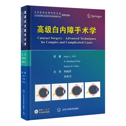 高级白内障手术学   宋旭东　刘兆川 主译   北医社 商品图0