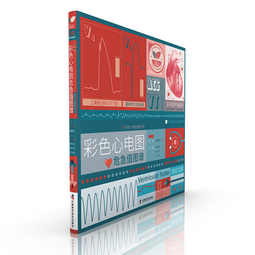 彩色心电图危急值图谱 全彩医学插画本 商品图0