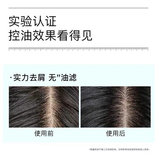 黛丝恩致美洗发水(去屑清爽型) 商品图6