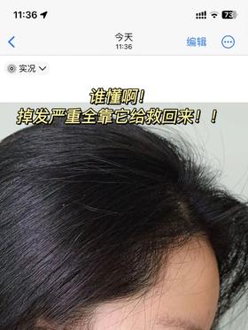 炸毛了😱你可以永远相信这瓶洗发水！！！