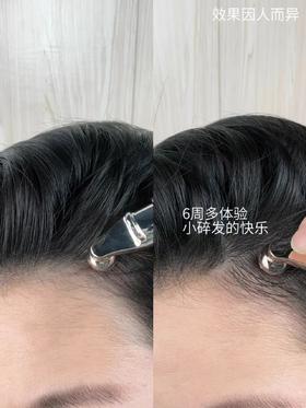 蒲公英女孩想要头发变多，就冲这一支！