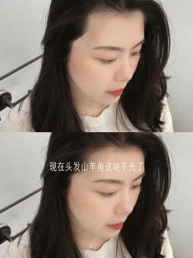 脆皮打工人的发量守护丨秃头女孩必备