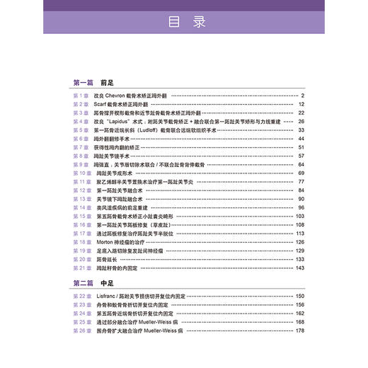 足踝外科手术学 第2二版 马昕 梁晓军译 25种全新术式拇外翻翻修手术关节镜下踌趾关节融合术临床手术准备预后 北京大学医学出版社 商品图4