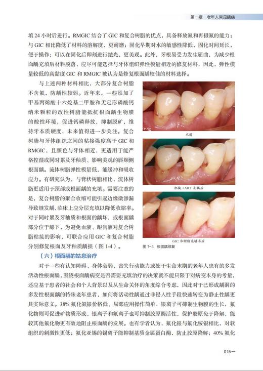 口腔全科门诊老年人口腔常见疾病诊疗和护理实践 商品图9