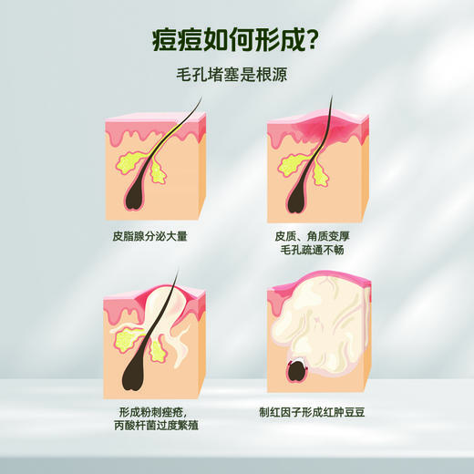 御豆堂牌草本祛痘皂 商品图4