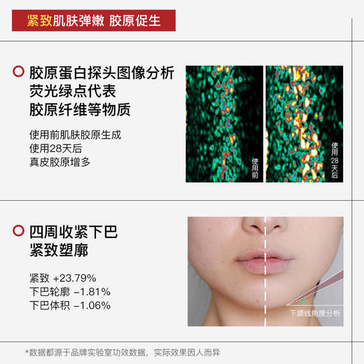 【一套满足日常需求，送礼品袋】Anfany五维三因抗皱紧致套盒 4重专利成分 实力抗皱 紧致提拉 补水保湿更年轻 商品图2