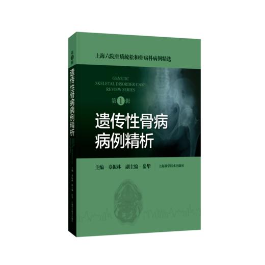 遗传性骨病病例精析（第1辑）上海六院骨质疏松和骨病科病例精选 内分泌代谢骨代谢 章振林主编 上海科学技术出版社9787547868614 商品图1