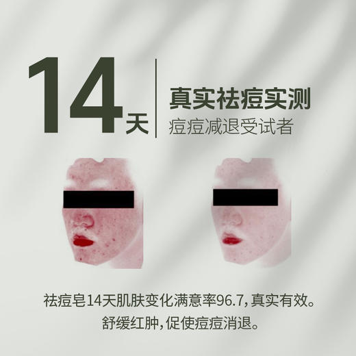 御豆堂牌草本祛痘皂 商品图5