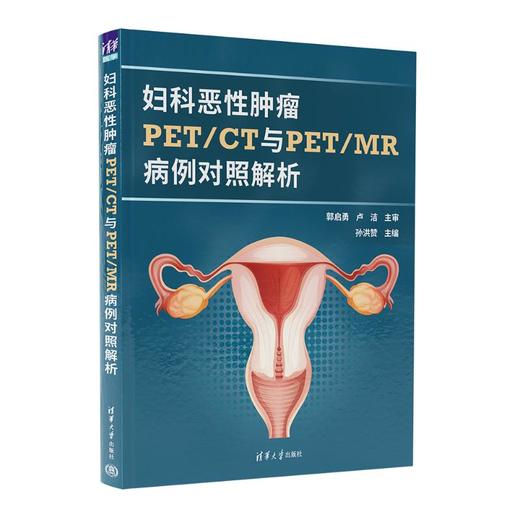 妇科恶性肿瘤PET/CT与PET/MR病例对照解析 商品图0