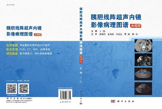 胰胆线阵超声内镜影像病理图谱：含视频/王伟 商品图3