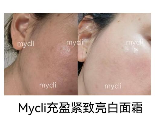 眼霜/面霜！【意大利MyCli麦可莉 360反重力眼霜15ml】淡化细纹黑眼圈紧致提拉上眼皮~ 面霜送15ml小样~眼霜日期 26年5月 商品图3