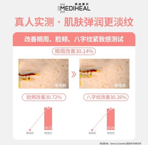 美迪惠尔舒缓泛红痘痘肌清洁毛孔组合湿敷棉片100片 商品图11
