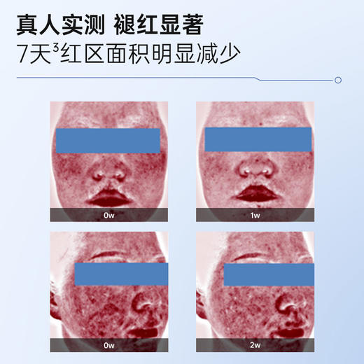 【双十二】绽媄娅医用皮肤修护水乳术后护理械字号补水敷料 商品图3