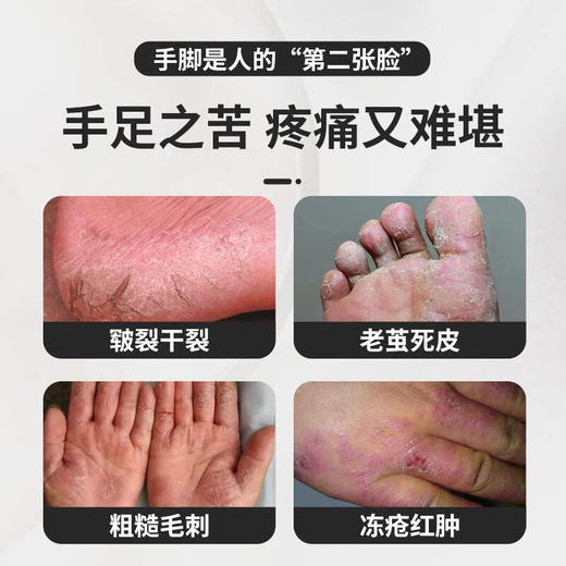 CINMOSE 辛莫斯牌 山金车花提取物膏 50g 商品图2