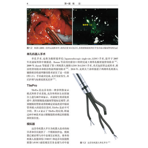 机器人尿路修复手术技术临床路径附视频 李学松 杨昆霖等译 系统性介绍机器人腹腔镜尿路修复重建技术9787117369411人民卫生出版社 商品图4
