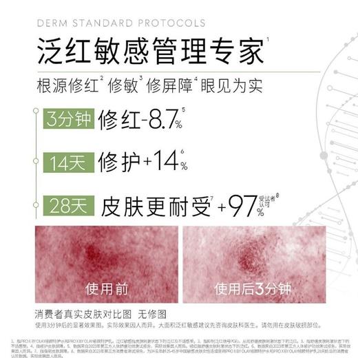 【新款】OLAY玉兰油修红特护水乳套装抗氧去红修护 商品图4