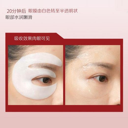 回馈！可吸收胶原蛋白眼膜细纹补水补胶原凹陷泪沟法令纹（10贴） 商品图3