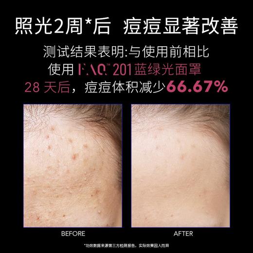 FAQ  芙颜珂御颜鎏光美肤面罩 201蓝绿光面罩/202彩虹光面罩光子嫩肤美容嫩肤 商品图2