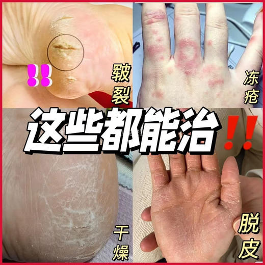 秋冬抗裂扛把子【日本東京生物蛇油 膏】 手脚容易干裂、皴裂、长冻疮的，一定要用!1罐=身体乳十护手霜“护足霜-冻疮膏精粹蛇油多重植物配方，温和不刺激!奶油霜状质地，味道清新，好推开好吸收 商品图2