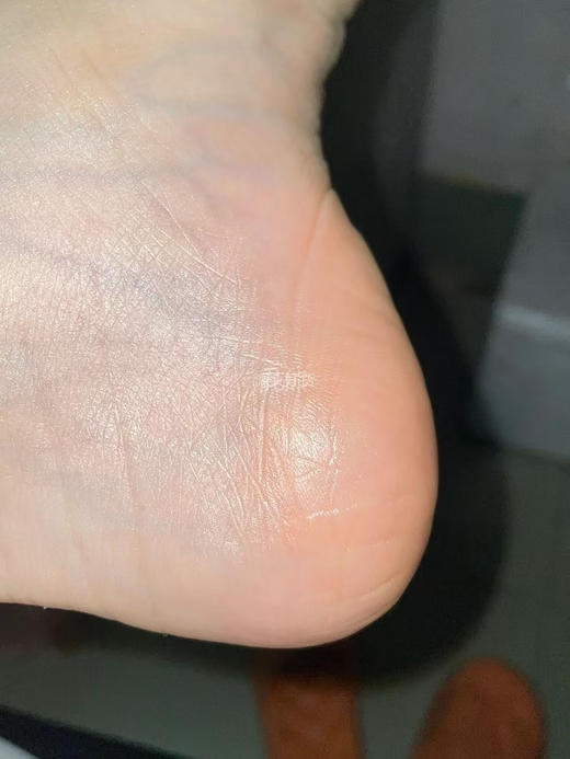 秋冬抗裂扛把子【日本東京生物蛇油 膏】 手脚容易干裂、皴裂、长冻疮的，一定要用!1罐=身体乳十护手霜“护足霜-冻疮膏精粹蛇油多重植物配方，温和不刺激!奶油霜状质地，味道清新，好推开好吸收 商品图3