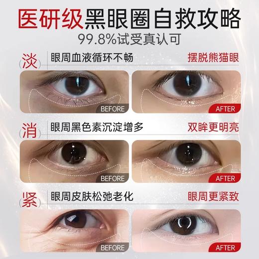 【KO黑眼圈 紧致淡眼纹】水润焕亮眼霜15g#眼霜淡化黑眼圈细纹提拉紧致抗皱去眼袋除神器男女正品官方旗舰店 商品图2