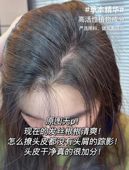 RinKuu植萃姜王强根健发洗发水 商品图2