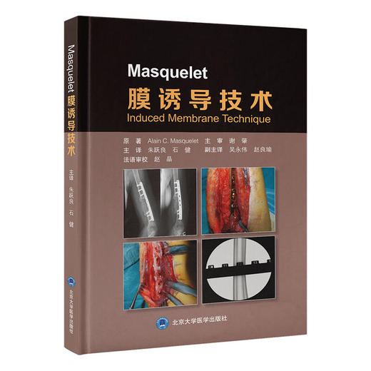Masquelet膜诱导技术 阐述了该技术的由来与实施方法以及卓有成效的治疗实践 商品图0