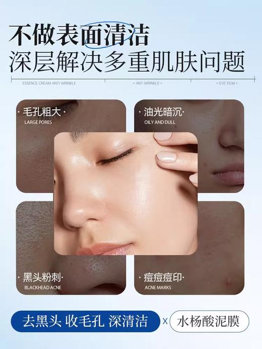 【1敷0黑头 全脸细腻】维生素原B5净肤面膜150g#水杨酸B5清洁泥膜去黑头收缩毛孔粉刺闭口面部脏东西涂抹式面膜 商品图5