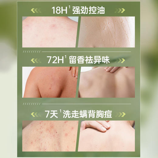 【99任选3件|均价￥33/件】沐浴露男士持久留香水72小时控油除螨祛痘沐浴露|儒意官方旗舰店 商品图2