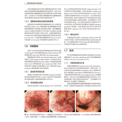 消化内镜治疗图谱 第2版 王伟岸 柴宁莉 消化内镜在消化疾病治疗中的应用 食管静脉曲张的内镜治疗 胃静脉曲张破裂出血的内镜治疗 商品图4