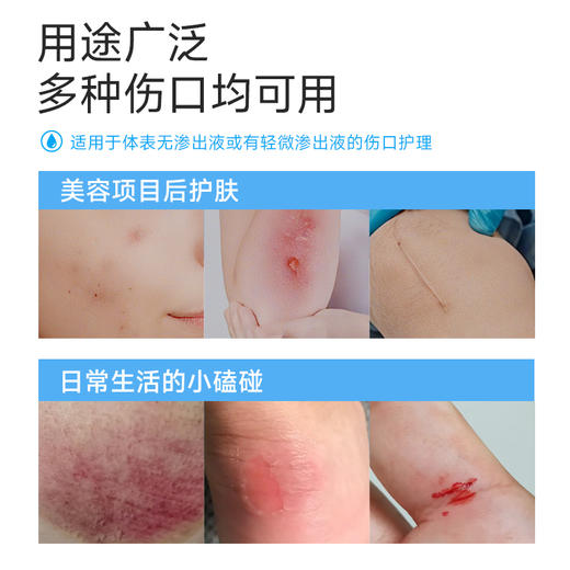 【创面呵护】水胶体医用敷料 5片/盒 商品图4