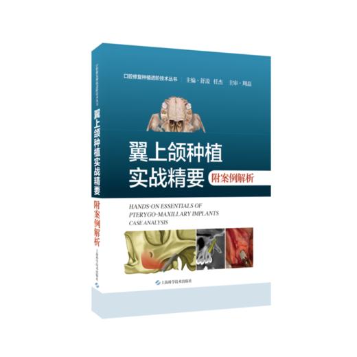 翼上颌种植实战精要  附案例解析 商品图0