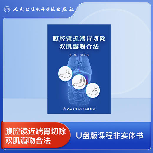 腹腔镜近端胃切除双肌瓣吻合法【U盘版】 商品图0