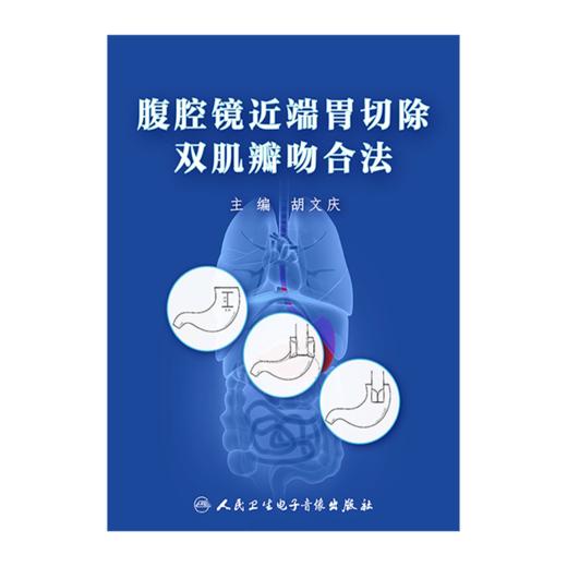 腹腔镜近端胃切除双肌瓣吻合法【U盘版】 商品图5