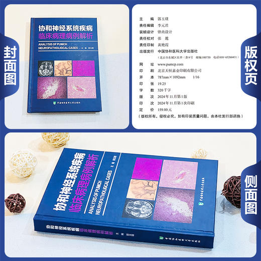 协和神经系统疾病临床病理病例解析 郭玉璞编 涵盖了神经系统各大类疾病如脑血管病 肿瘤 感染性疾病 免疫性疾病 遗传病 变性病等 商品图1